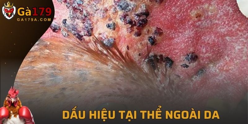 Dấu hiệu tại thể ngoài da