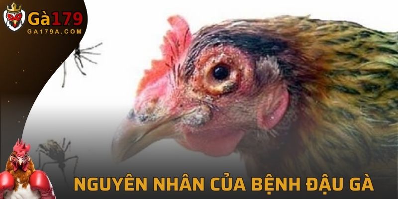 Nguyên nhân gây ra của bệnh đậu gà